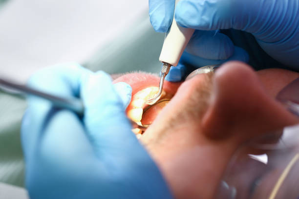Best Broken Tooth Emergency  in Marietta, OH