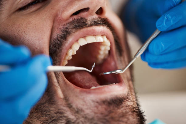 Best Emergency Tooth Extraction  in Marietta, OH